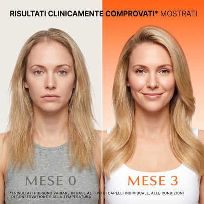 SCALÉA™ — Siero Rivitalizzante per il Cuoio Capelluto con Applicatore Massaggiante